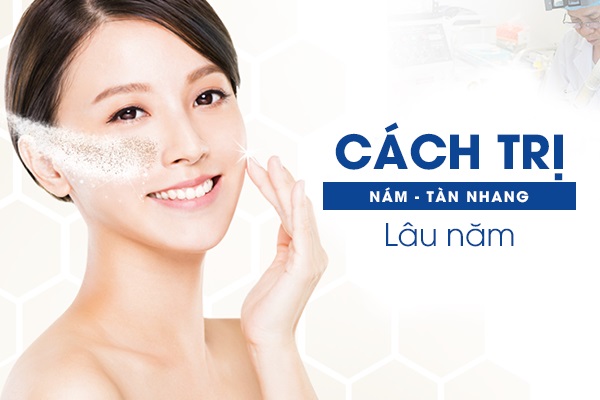 4 cách trị nám tàn nhang hiệu quả từ thiên nhiên